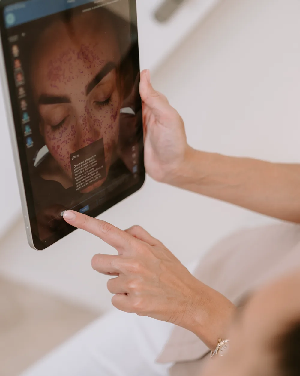 Analiza skóry na diagnostycznym obrazie cery trądzikowej, Skin Alchemy